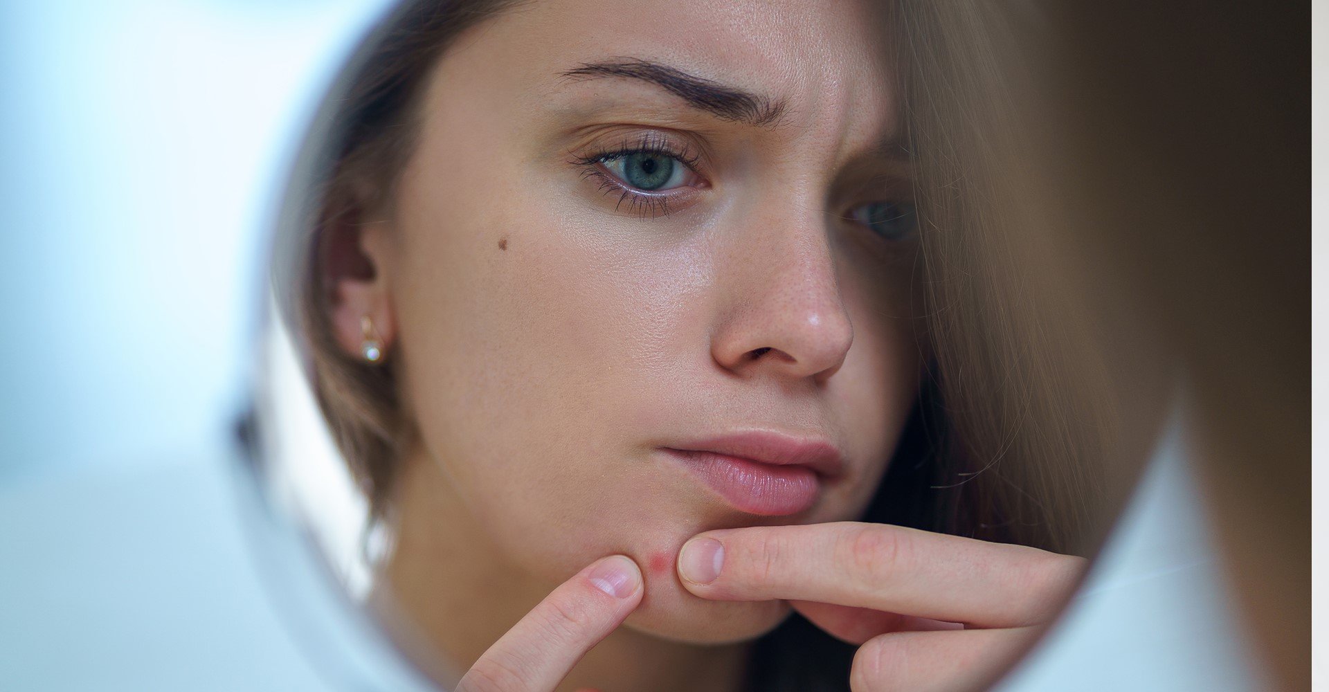 Modelo branca olhando pelo espelho acne em seus rosto